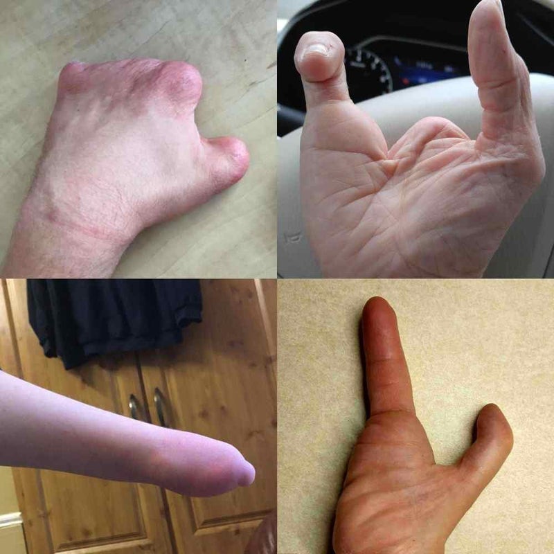 active hands Limb Difference gripping aid (Standard, Left) - Image 2